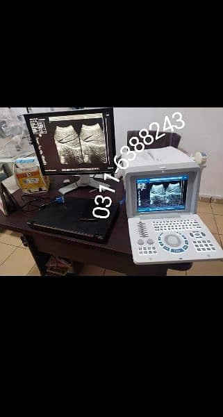 Ultrasound machine 1