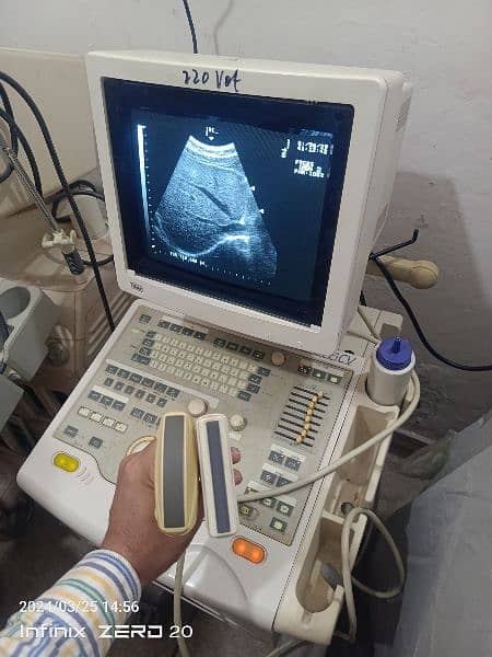 Ultrasound machine 7