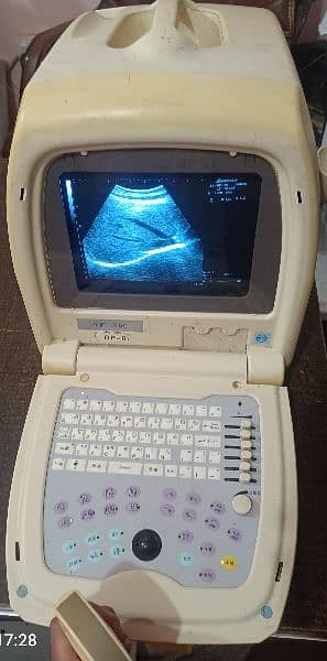 Ultrasound machine 14