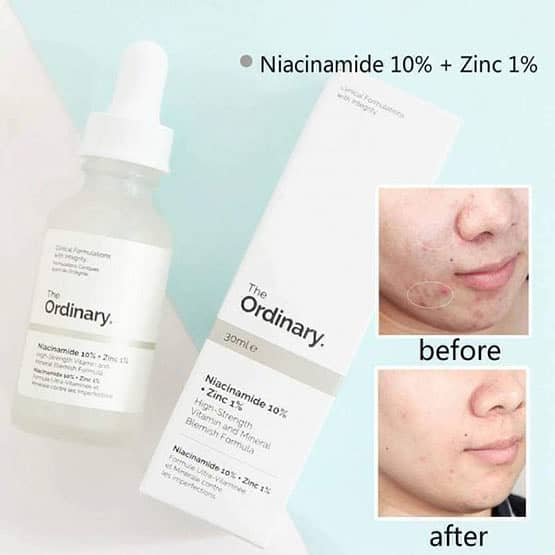 The Ordinary Niacinamide 10% + Zinc 1% Perfecting Serum for Fairness 2