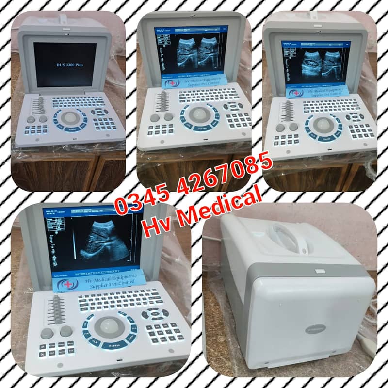 Brand New Chinese Ultrasound Machine (with or without BATTERY BACK UP 0