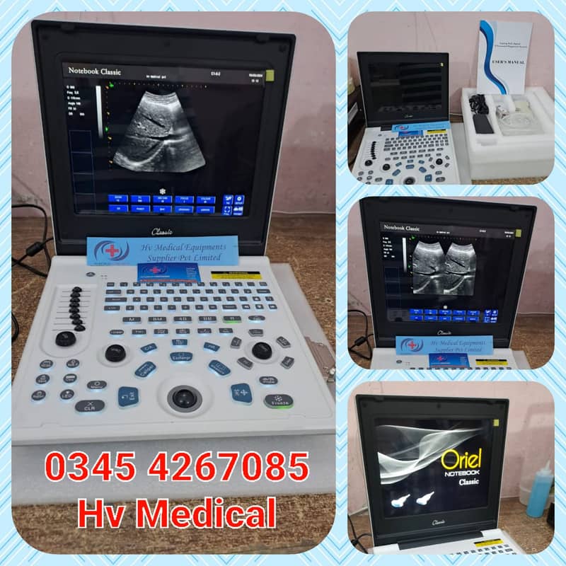Brand New Chinese Ultrasound Machine (with or without BATTERY BACK UP 1