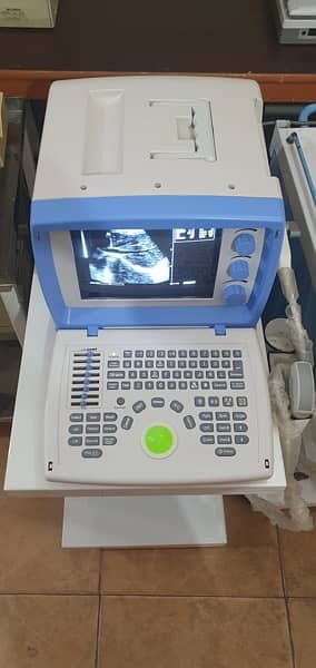 Ultrasound  machine  Used Only 15 days Brilliant  Condition Probe 2
