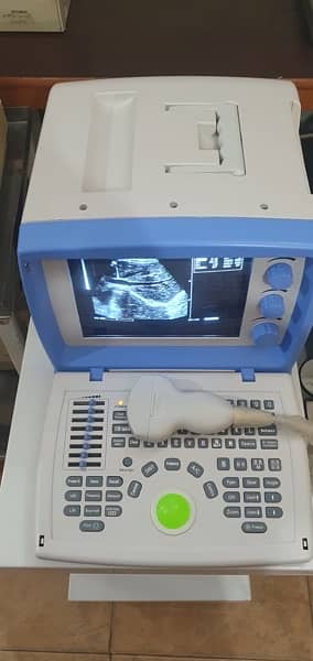 Ultrasound  machine  Used Only 15 days Brilliant  Condition Probe 5