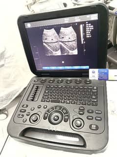 Brand New Ultrasound Machine Portable with Battery 0