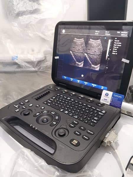 Brand New Ultrasound Machine Portable with Battery 2