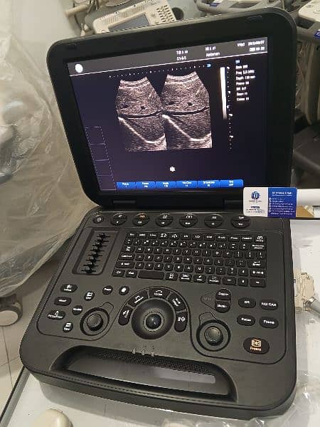 Brand New Ultrasound Machine Portable with Battery 3