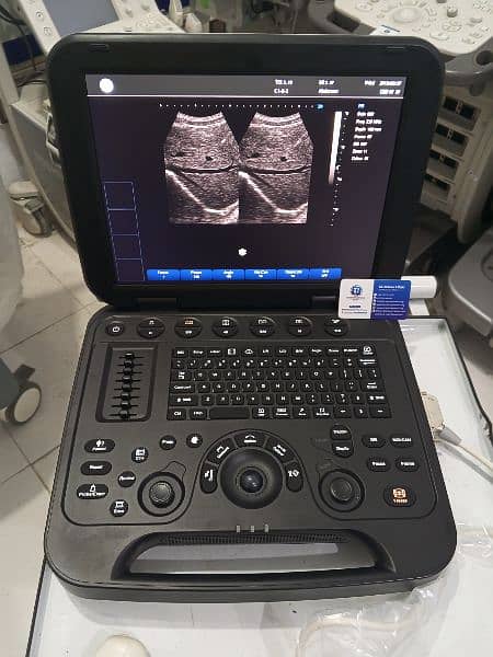 Brand New Ultrasound Machine Portable with Battery 4