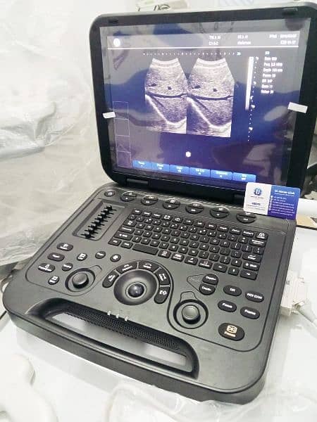 Brand New Ultrasound Machine Portable with Battery 6