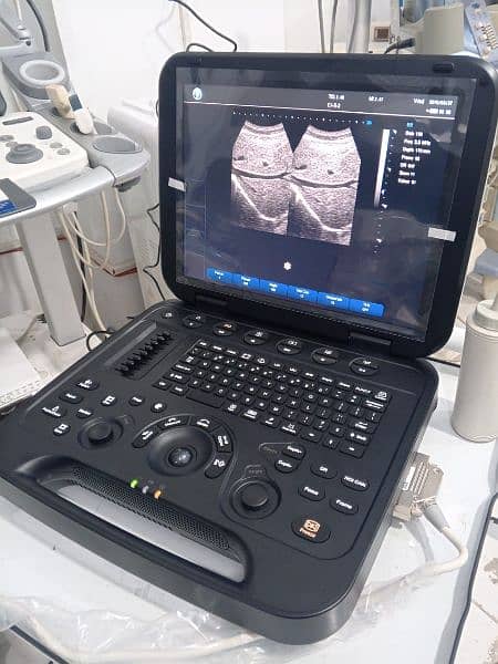 Brand New Ultrasound Machine Portable with Battery 7