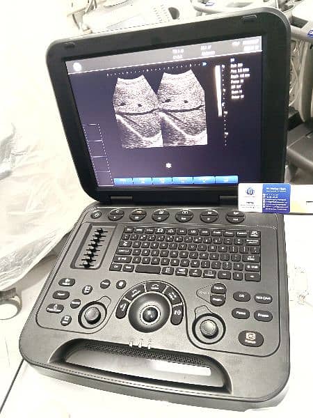 Brand new Ultrasound Machines with battery backup 0