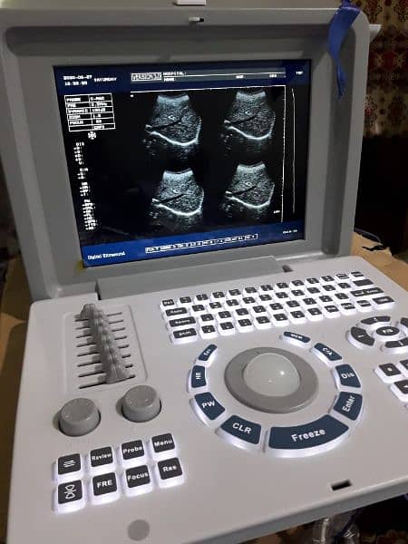 Ultrasound machines 3