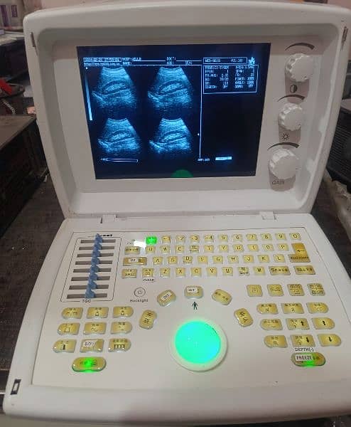 Ultrasound machines 9