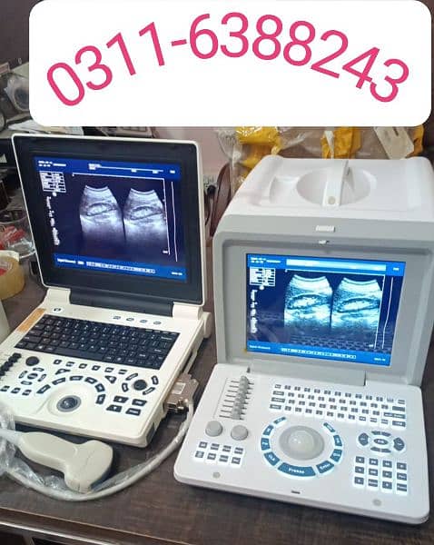 Ultrasound machine 1