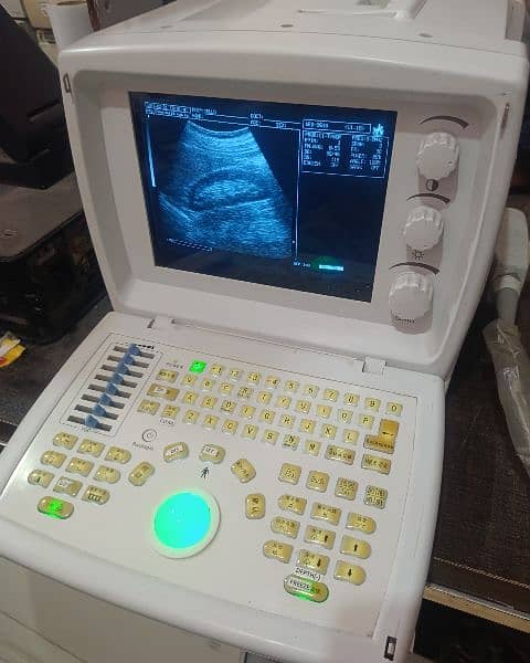 Ultrasound machine 4