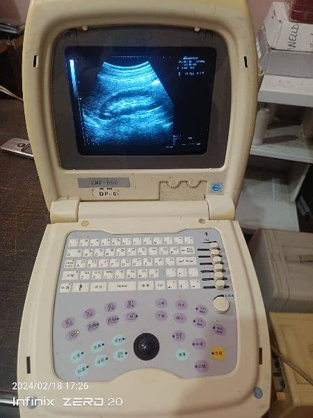 Ultrasound machine 12