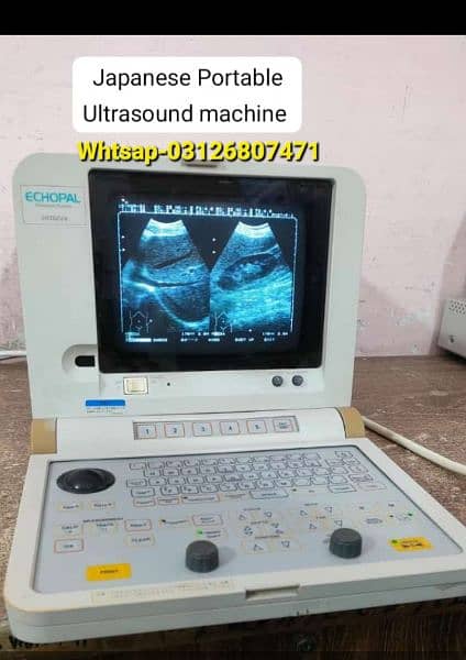 Ultrasound machine offer Whtsap-03126807471 1