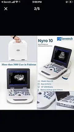 Nyro10 Notebook Humen / Vet Livestock Ultrasound Machine in Best Price 0