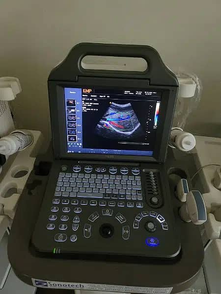 New portable Color Doppler ultrasound machines at wholesale prices 0