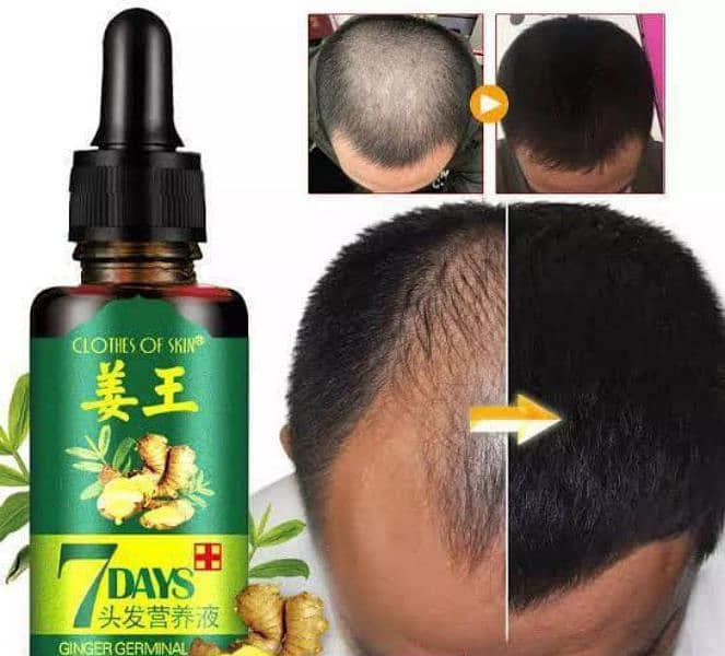 Hair Regrow Products,Oil, Serum, Shampo,Gel,Hair Colour products 2