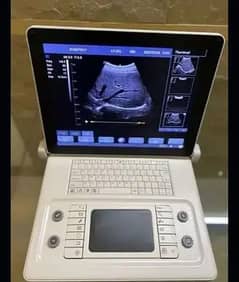 D8 portable notebook Highly professional Ultrasound Machine 15"LED