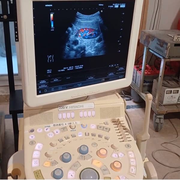 Foreign Used Hitachi Avius Color Doppler Trolley Mounted Ultrasound Ma 1