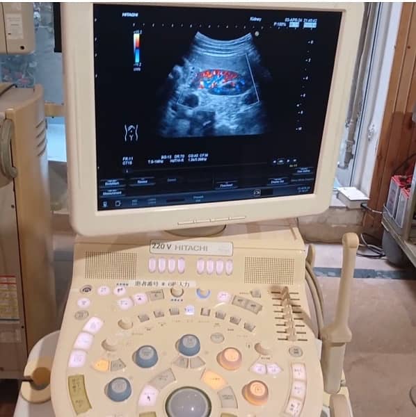Foreign Used Hitachi Avius Color Doppler Trolley Mounted Ultrasound Ma 2