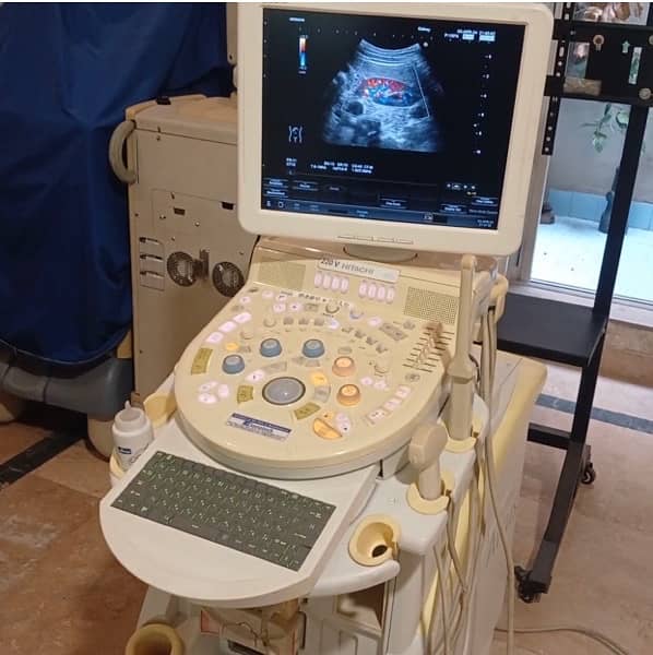 Foreign Used Hitachi Avius Color Doppler Trolley Mounted Ultrasound Ma 3