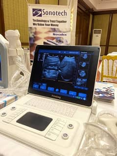 Brand New Youkey D8 Portable Notbook Ultrasound Machin Best Price Paak
