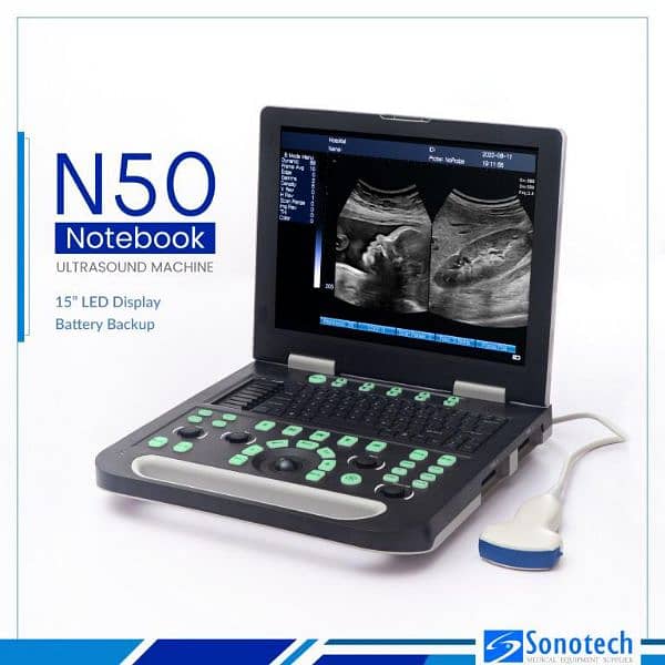 Novadex N50 protable Ultrasound Machine with long bettery backup 1