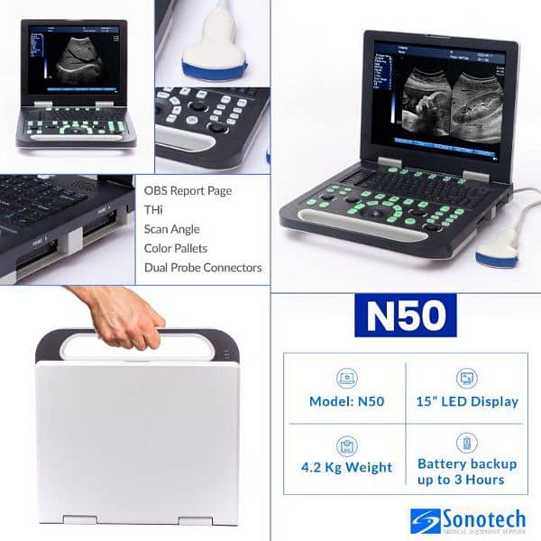 Novadex N50 protable Ultrasound Machine with long bettery backup 2
