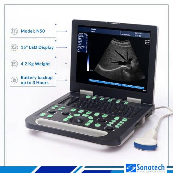 Novadex N50 protable Ultrasound Machine with long bettery backup 3
