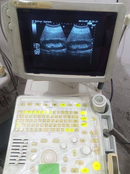 Ultrasound machine Sale offer Whtsap-03126807471 0
