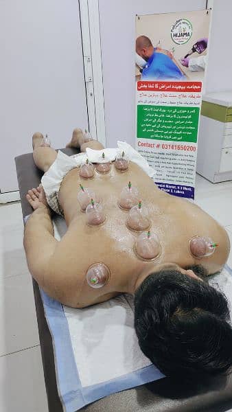 Hijama Cupping Therapy Lahore  Doctor Clinic Hospital Skin Hair Herbal 1