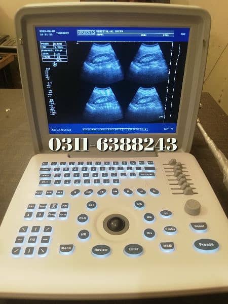 Ultrasound machines 10