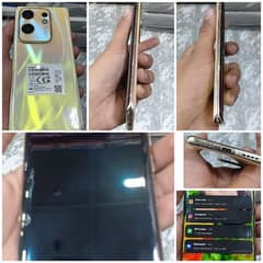 infinix Zero 30   condition 10/10 bix charger each and everything s ok