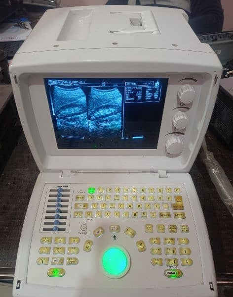 Ultrasound machine 6