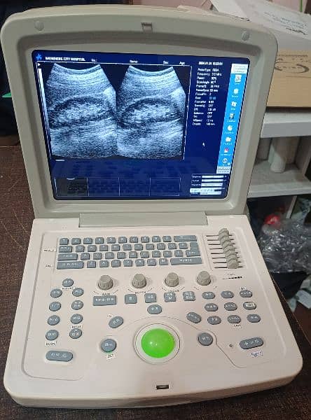All types of ultrasound machines available in low prices 11