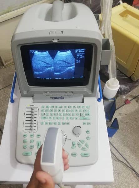ultrasound machines 2
