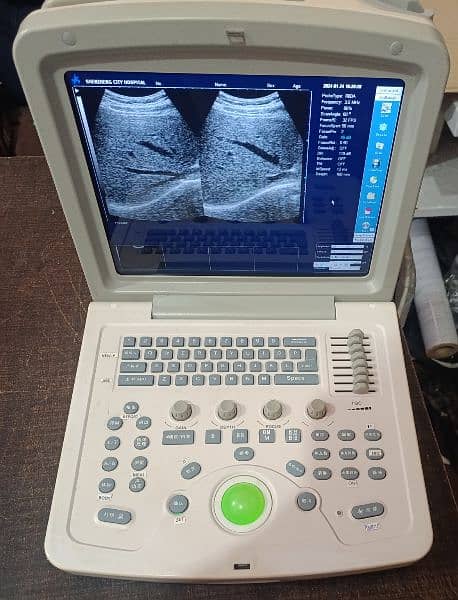 ultrasound machines 16