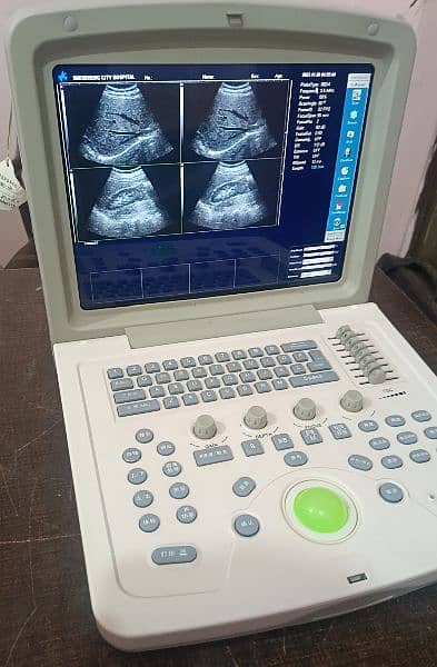 All types of ultrasound machines available in low prices 9