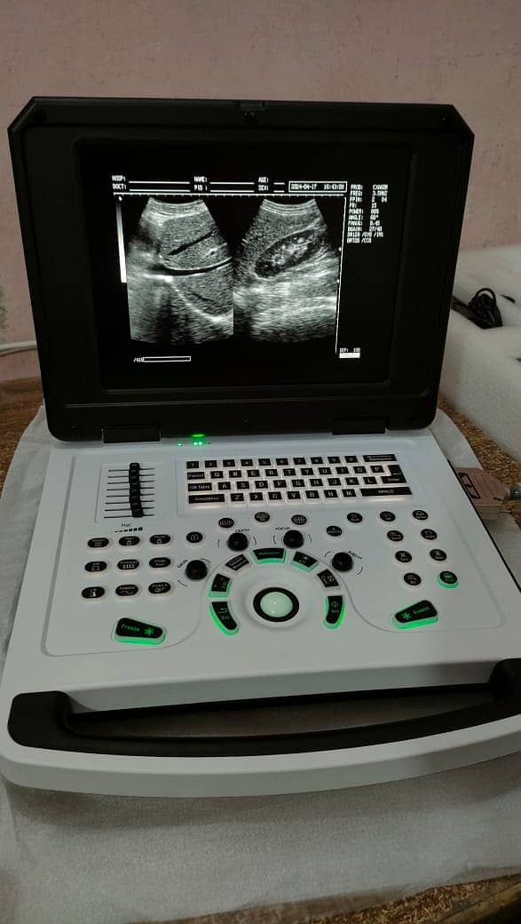 Brand New Chinese Ultrasound Machine (with or without BATTERY BACK UP 4