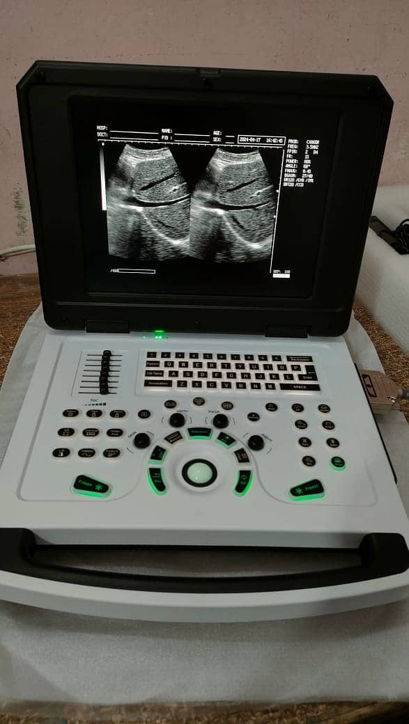 Brand New Chinese Ultrasound Machine (with or without BATTERY BACK UP 5