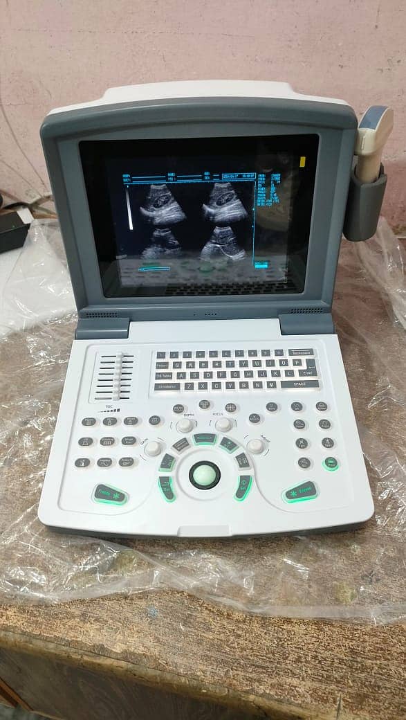 Brand New Chinese Ultrasound Machine (with or without BATTERY BACK UP 6