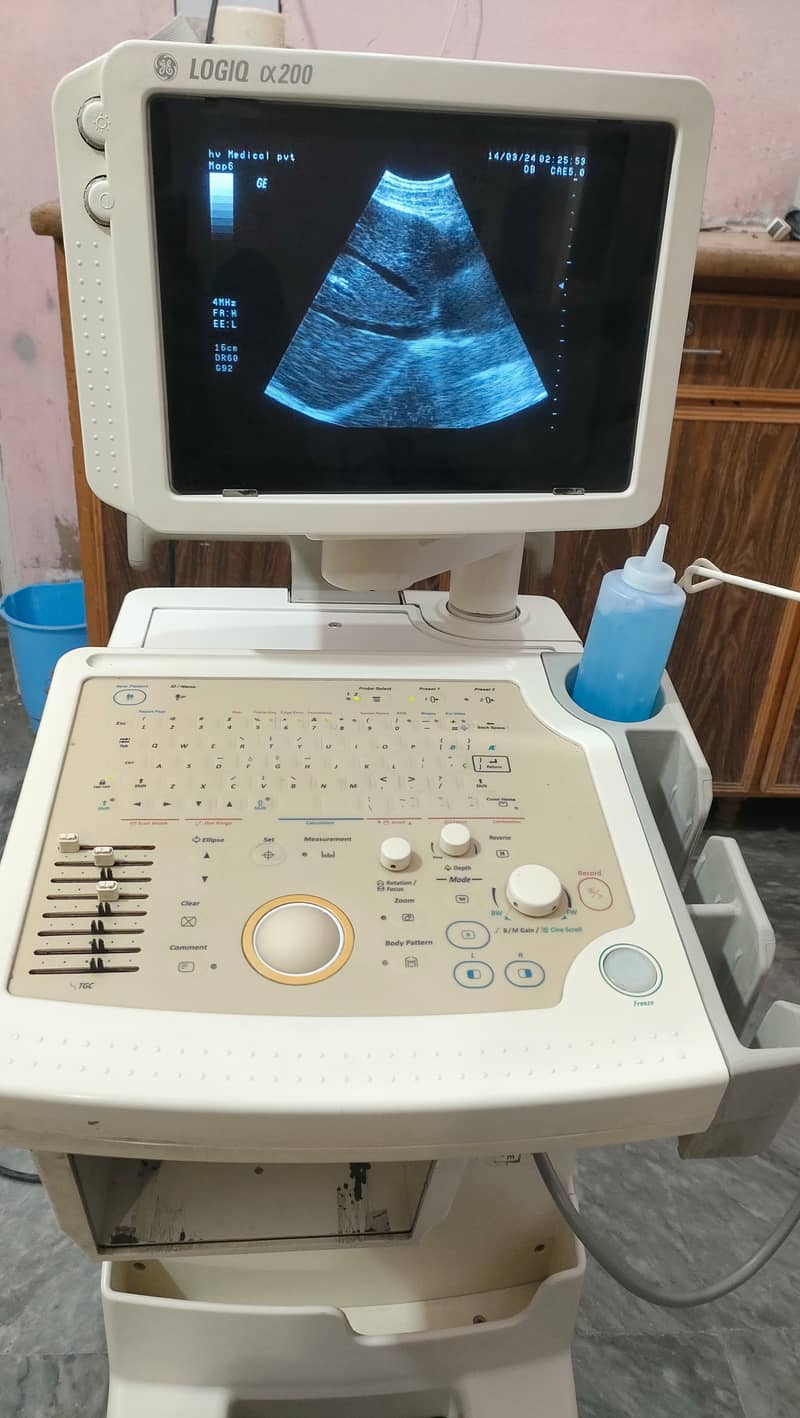 USED JAPANESE GRAYSCALE ULTRASOUND FOR SALE IN LOW PRICE 0