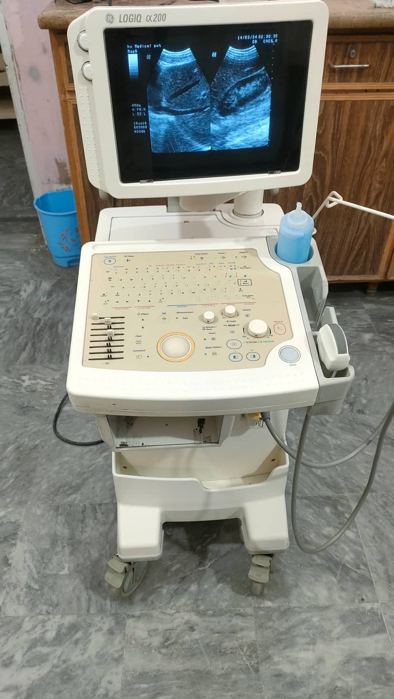 USED JAPANESE GRAYSCALE ULTRASOUND FOR SALE IN LOW PRICE 1