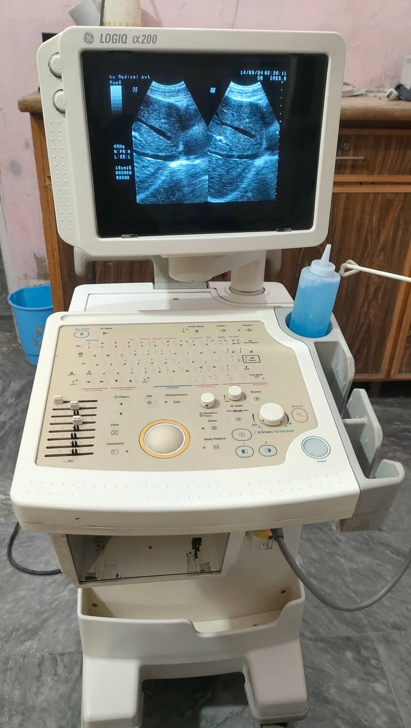 USED JAPANESE GRAYSCALE ULTRASOUND FOR SALE IN LOW PRICE 2