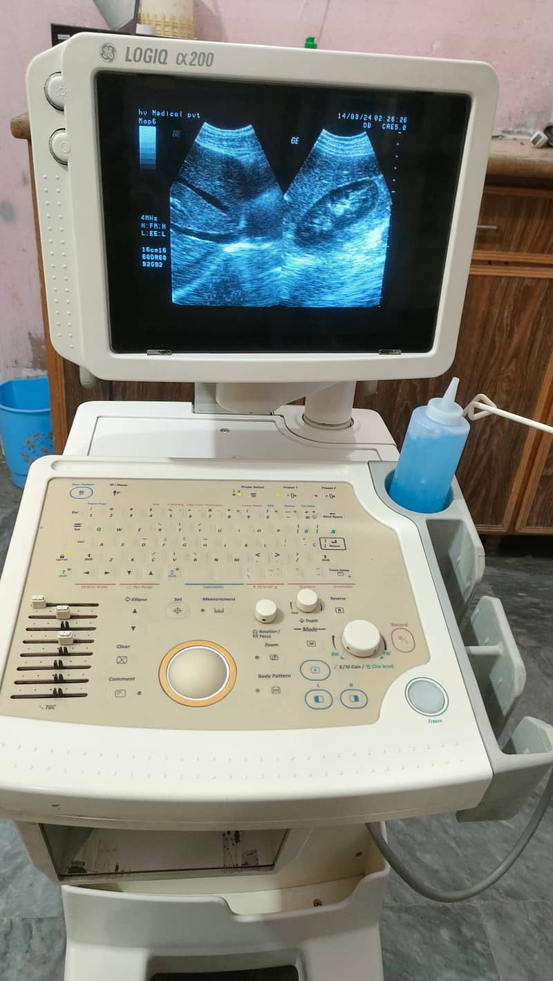 USED JAPANESE GRAYSCALE ULTRASOUND FOR SALE IN LOW PRICE 4