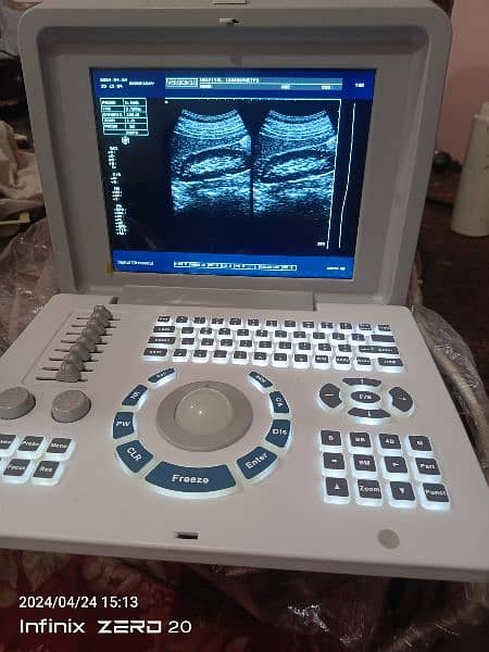 Ultrasound machine 2