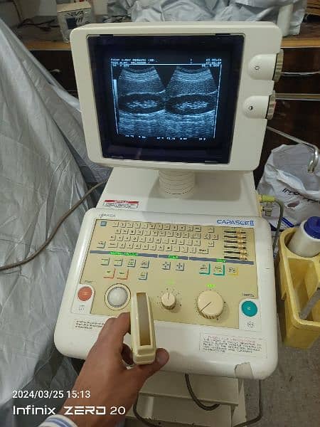 Ultrasound machine 5